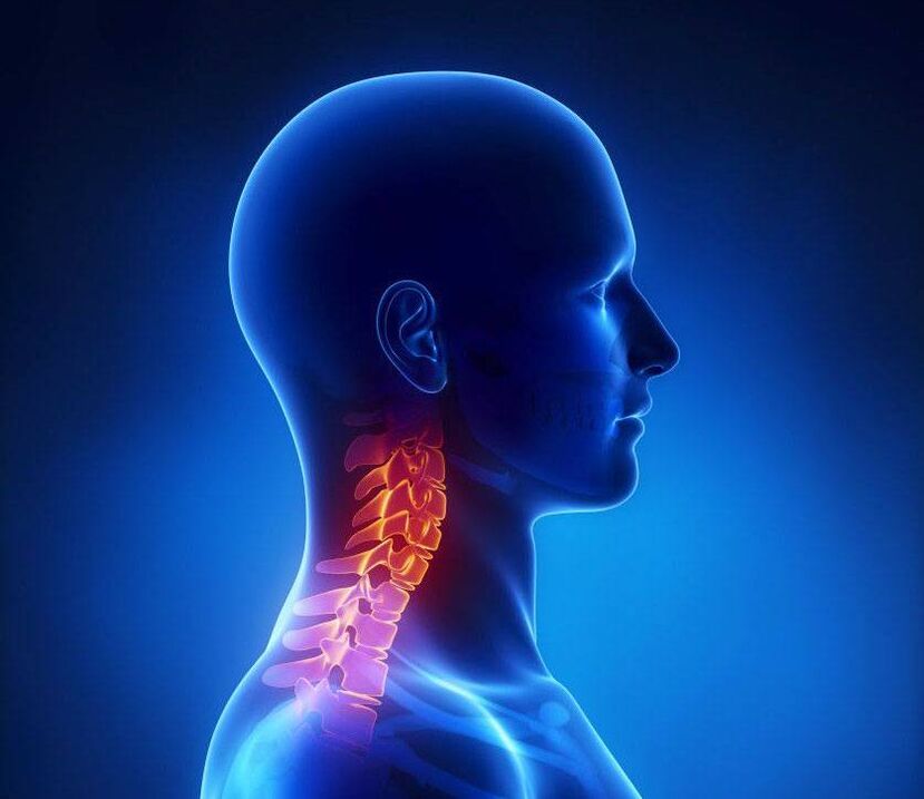 a nyaki gerinc osteochondrosis