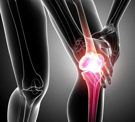 milyen termékeket kell kizárni a térdízület artrózisával fájdalom a láb belsejében az ízület alatt