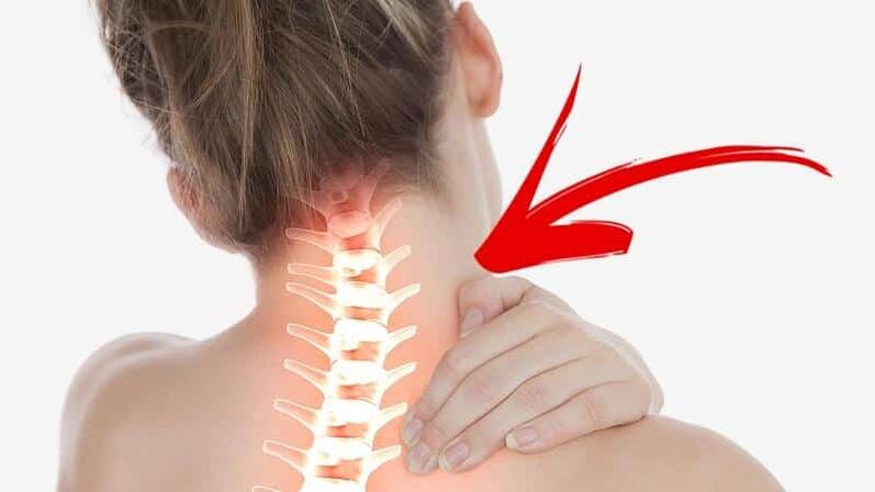 Terápiás gyakorlatokat igénylő nyaki osteochondrosis