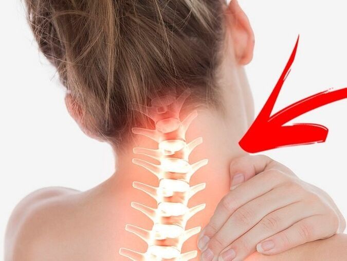 Ideggyökerek kompressziója méhnyakos osteochondrosissal